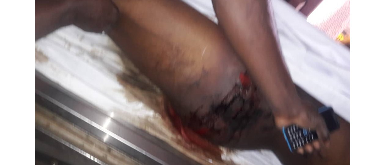 {Vantant&nbsp;urbi&nbsp;et&nbsp;orbi&nbsp;son souci des droits de l’homme, la torture est pourtant largement pratiquée au Gabon,&nbsp;en&nbsp;toute impunité.}