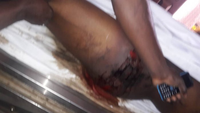 {Vantant urbi et orbi son souci des droits de l’homme, la torture est pourtant largement pratiquée au Gabon, en toute impunité.}. Photo: Droits réservés/Gabon Intelligent